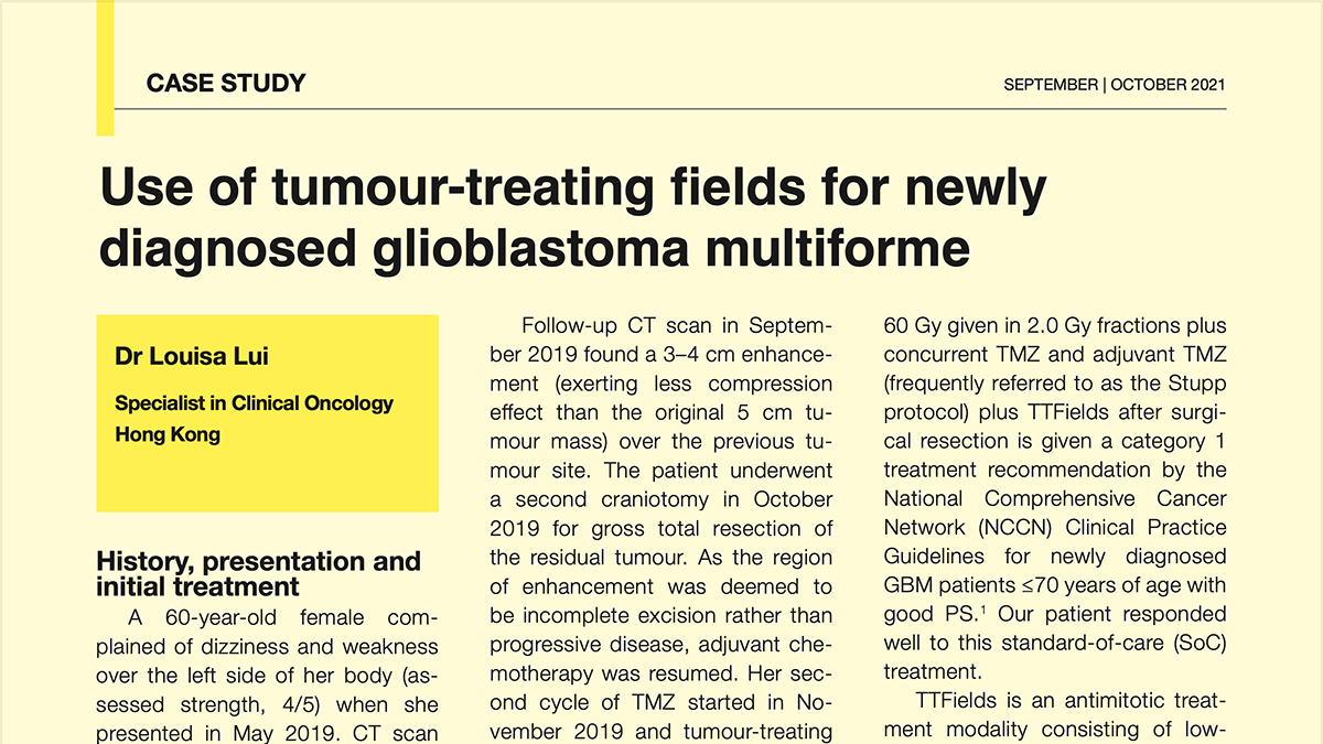[Case study] Use of tumour-treating fields for newly diagnosed glioblastoma multiforme – Dr. Louisa Lui, Hong Kong (19 Oct 2021)